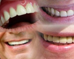 Slider image (10) PruDent-Hungary